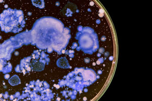 Bacteria Sample Petri Dish From Well Water